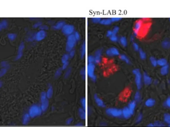  Immunofluorescence analysis using anti-C. difficile SlpA serum reveals intense staining in the colonic lumen of Syn-LAB 2.0-fed animals (right), but not mock-treated animals (left)