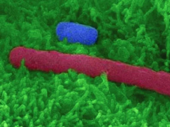  False-color SEM of a C. difficile spore (blue) and vegetative cell (red)