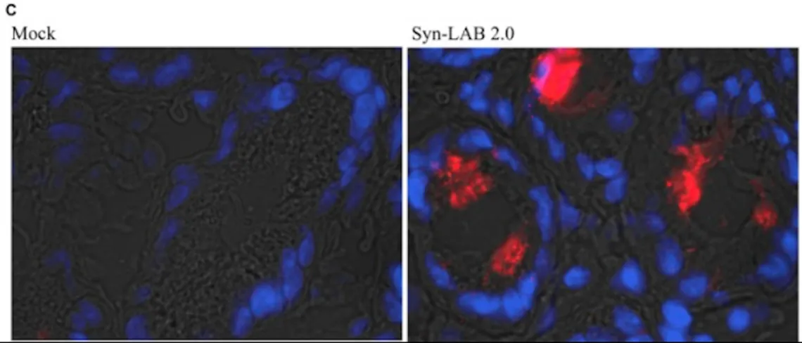  Immunofluorescence analysis using anti-C. difficile SlpA serum reveals intense staining in the colonic lumen of Syn-LAB 2.0-fed animals (right), but not mock-treated animals (left)