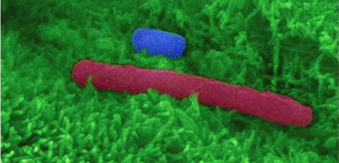  False-color SEM of a C. difficile spore (blue) and vegetative cell (red)